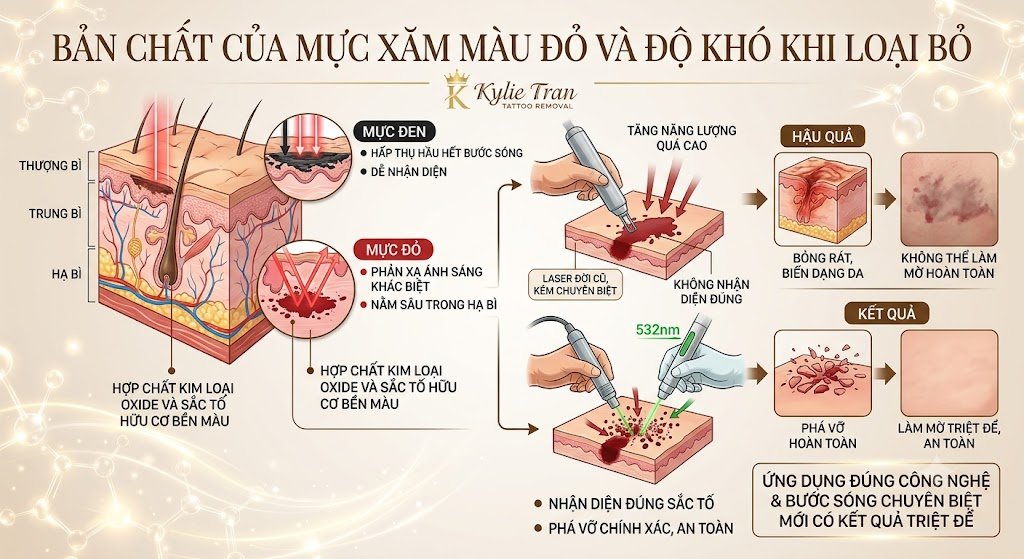 Xóa xăm màu đỏ bằng laser có hết không? Giải đáp từ chuyên gia